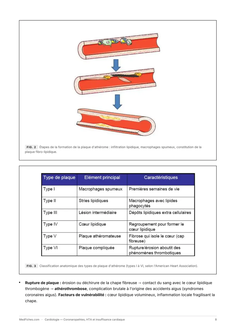 Cardiologie, Coronaropathies, HTA et insuffisance cardiaque, page 3
