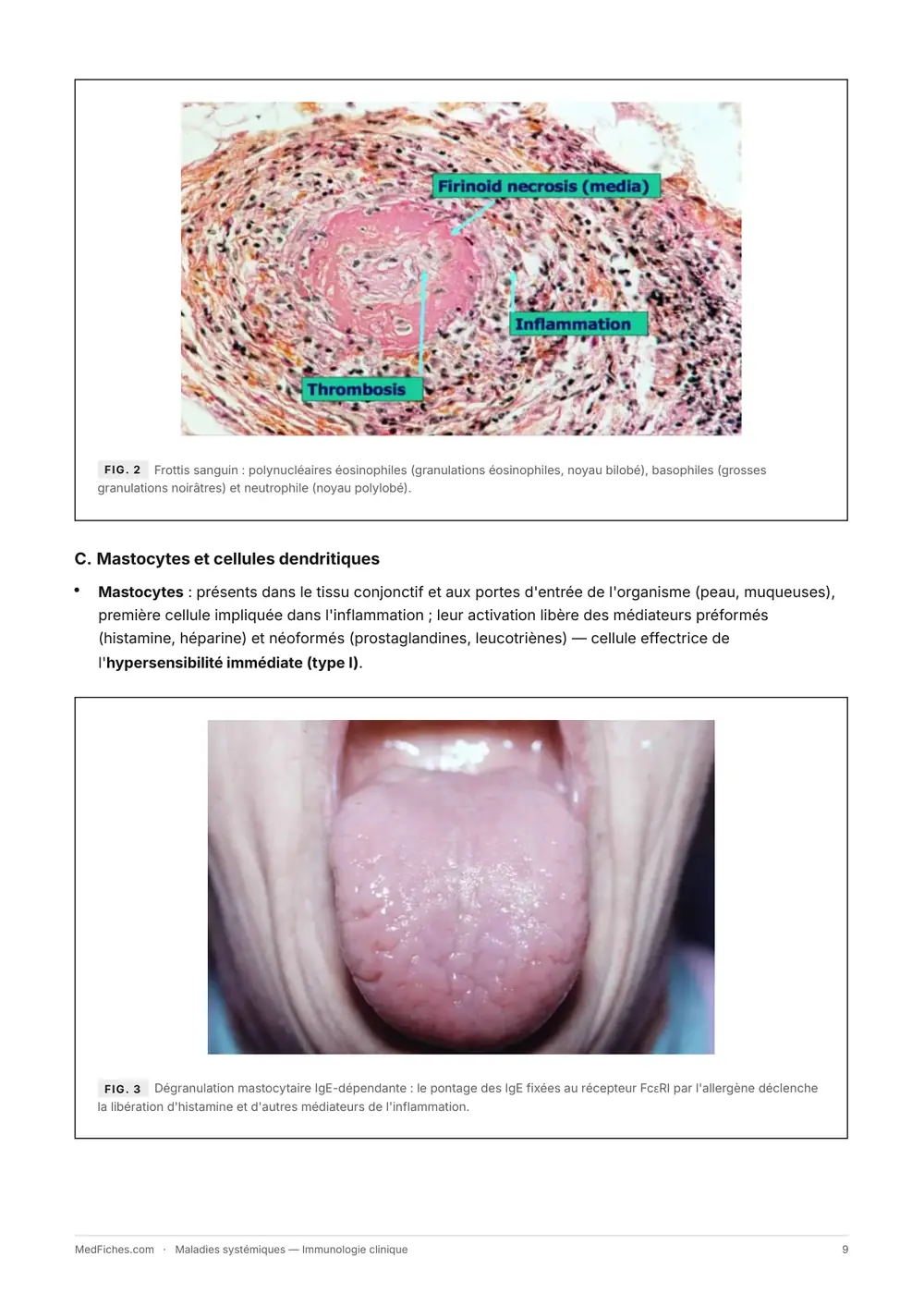 Maladies systémiques, Immunologie clinique, page 4