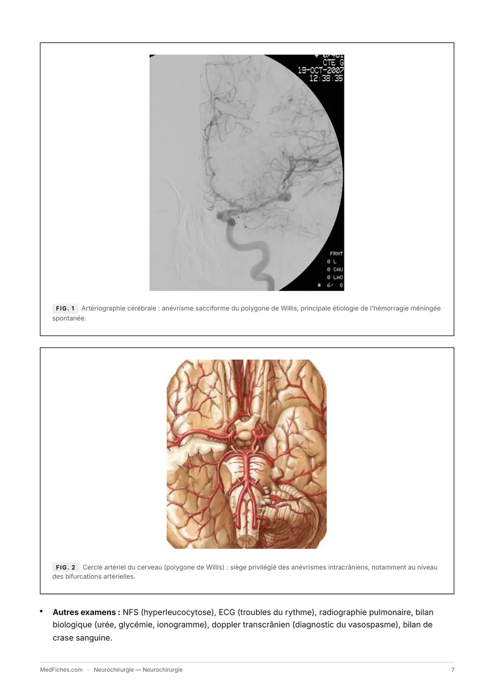 Neurochirurgie, Début du manuel, page 4