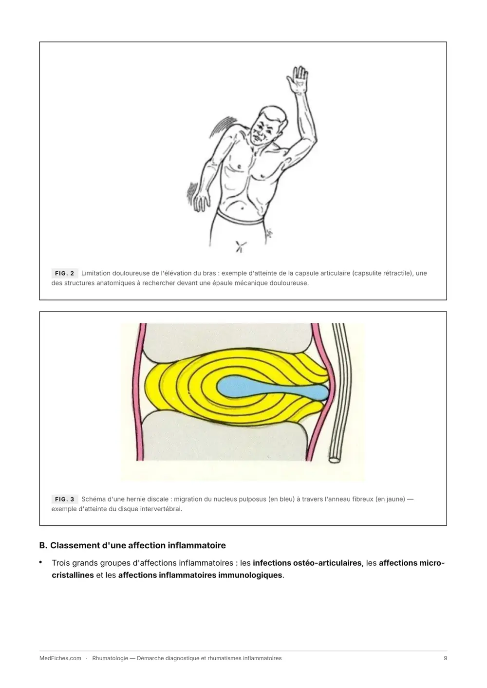 Rhumatologie, Démarche diagnostique et rhumatismes inflammatoires, page 5
